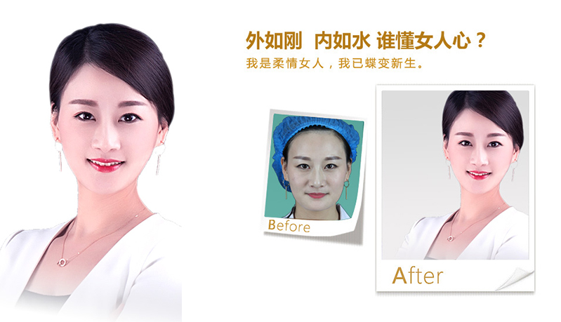 台州V脸、线雕隆鼻